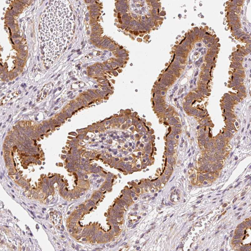 Immunohistochemistry (Formalin/PFA-fixed paraffin-embedded sections) - Anti-EEF1A2 antibody (AB212172), expandable thumbnail