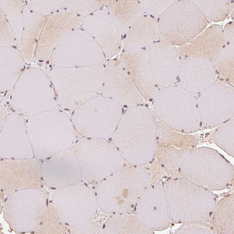 Immunohistochemistry (Formalin/PFA-fixed paraffin-embedded sections) - Anti-EEF1A2 antibody (ab212172), expandable thumbnail