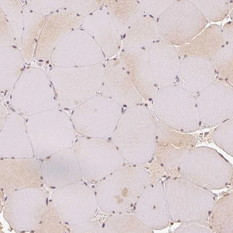 Immunohistochemistry (Formalin/PFA-fixed paraffin-embedded sections) - Anti-EEF1A2 antibody (AB212172)