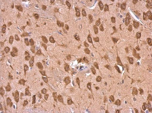 Immunohistochemistry (Formalin/PFA-fixed paraffin-embedded sections) - Anti-EEF1A2 antibody (AB227275)
