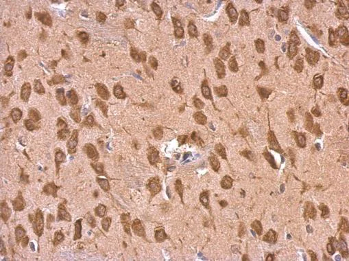 Immunohistochemistry (Formalin/PFA-fixed paraffin-embedded sections) - Anti-EEF1A2 antibody (AB227275)