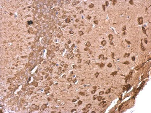 Immunohistochemistry (Formalin/PFA-fixed paraffin-embedded sections) - Anti-EEF1A2 antibody (AB227275)