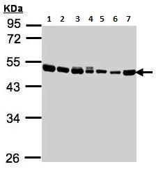 Western blot - Anti-EEF1A2 antibody (AB227275)