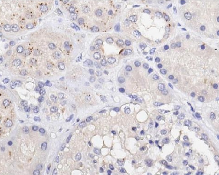 Immunohistochemistry (Formalin/PFA-fixed paraffin-embedded sections) - Anti-EEF1A2 antibody (AB235190)