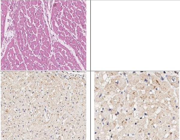 Immunohistochemistry (Formalin/PFA-fixed paraffin-embedded sections) - Anti-EEF1A2 antibody (AB235235)