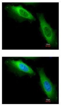 Immunocytochemistry/ Immunofluorescence - Anti-eEF1B2 antibody (AB228642)