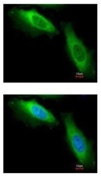 Immunocytochemistry/ Immunofluorescence - Anti-eEF1B2 antibody (AB228642)