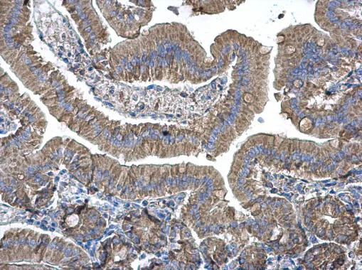 Immunohistochemistry (Formalin/PFA-fixed paraffin-embedded sections) - Anti-eEF1B2 antibody (AB228642)