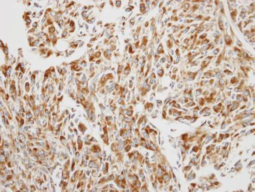 Immunohistochemistry (Formalin/PFA-fixed paraffin-embedded sections) - Anti-eEF1B2 antibody (AB228642)