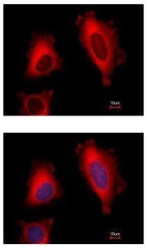 Immunocytochemistry/ Immunofluorescence - Anti-EEF1D antibody (AB228803), expandable thumbnail