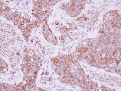 Immunohistochemistry (Formalin/PFA-fixed paraffin-embedded sections) - Anti-EEF1D antibody (AB228803)