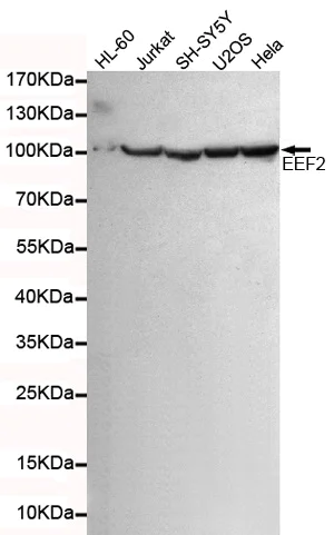 Western blot - Anti-EEF2/Elongation factor 2 antibody [4B3-G7-H5] (AB131202)