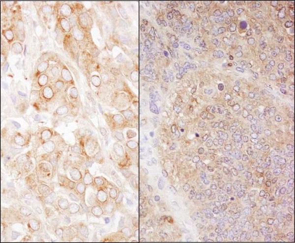 Immunohistochemistry (Formalin/PFA-fixed paraffin-embedded sections) - Anti-EEF2/Elongation factor 2 antibody (AB245412), expandable thumbnail