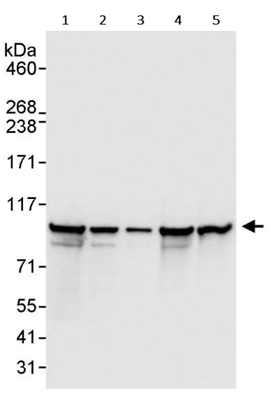 Western blot - Anti-EEF2/Elongation factor 2 antibody (AB245412)