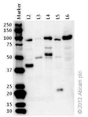 Western blot - Anti-EEF2/Elongation factor 2 antibody (AB33523)