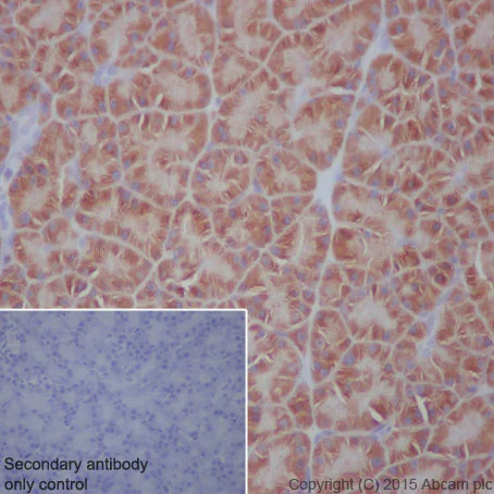 Immunohistochemistry (Formalin/PFA-fixed paraffin-embedded sections) - Anti-EEF2/Elongation factor 2 antibody [EP880Y] (AB75748)
