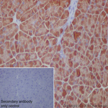 Immunohistochemistry (Formalin/PFA-fixed paraffin-embedded sections) - Anti-EEF2/Elongation factor 2 antibody [EP880Y] - BSA and Azide free (AB247388)