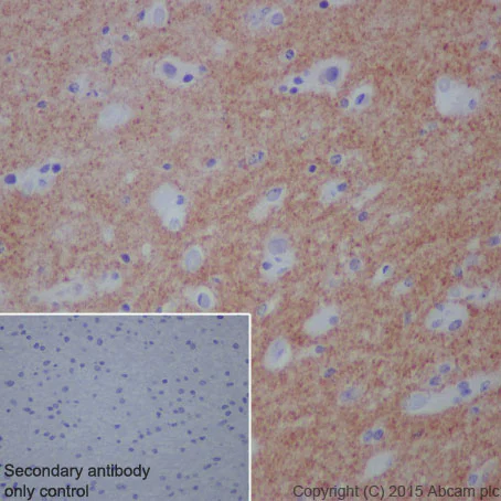 Immunohistochemistry (Formalin/PFA-fixed paraffin-embedded sections) - Anti-EEF2/Elongation factor 2 antibody [EP880Y] - BSA and Azide free (AB247388)