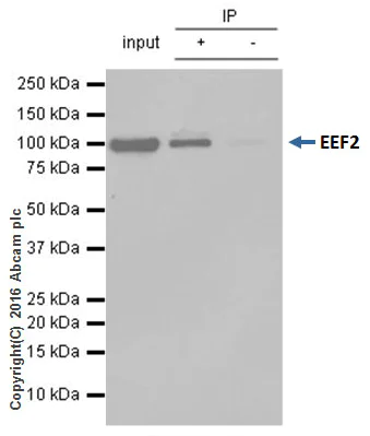 Immunoprecipitation - Anti-EEF2/Elongation factor 2 antibody [EP880Y] - BSA and Azide free (AB247388)