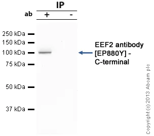 Immunoprecipitation - Anti-EEF2/Elongation factor 2 antibody [EP880Y] - BSA and Azide free (AB247388)