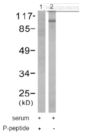 Western blot - Anti-EEF2/Elongation factor 2 (phospho T56) antibody (AB53114)