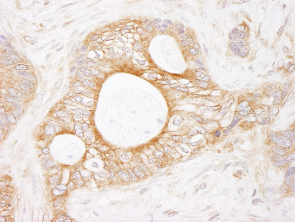 Immunohistochemistry (Formalin/PFA-fixed paraffin-embedded sections) - Anti-EEF2K antibody (AB85721)