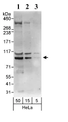 Western blot - Anti-EEF2K antibody (AB85721)