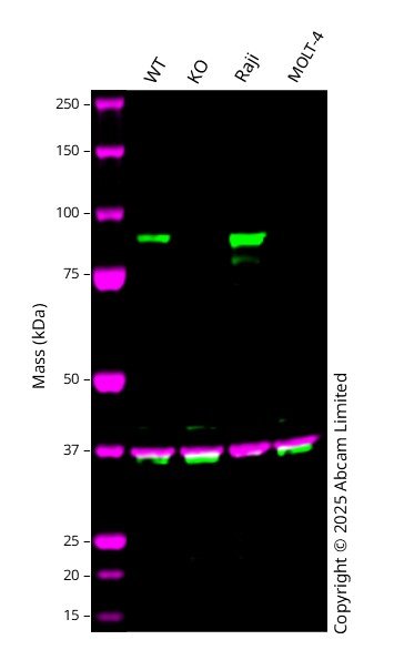 Western blot - Anti-EEF2K antibody [EP724Y] (AB46787)