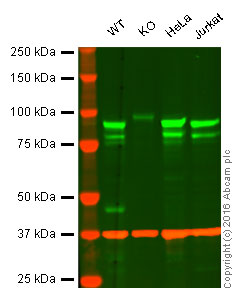 Western blot - Anti-EEF2K antibody [EP724Y] (AB46787), expandable thumbnail