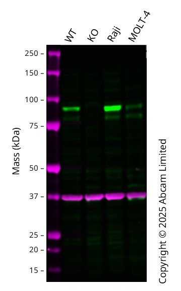 Western blot - Anti-EEF2K antibody [EP881Y] (AB45168), expandable thumbnail