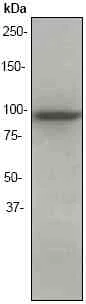 Western blot - Anti-EEF2K antibody [EP881Y] (AB45168)