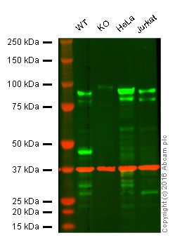 Western blot - Anti-EEF2K antibody [EP881Y] (AB45168), expandable thumbnail