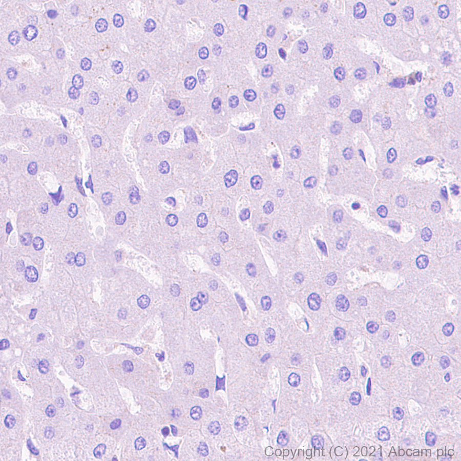 Immunohistochemistry (Formalin/PFA-fixed paraffin-embedded sections) - Anti-EEF2K antibody [EPR24714-88] (AB270948)