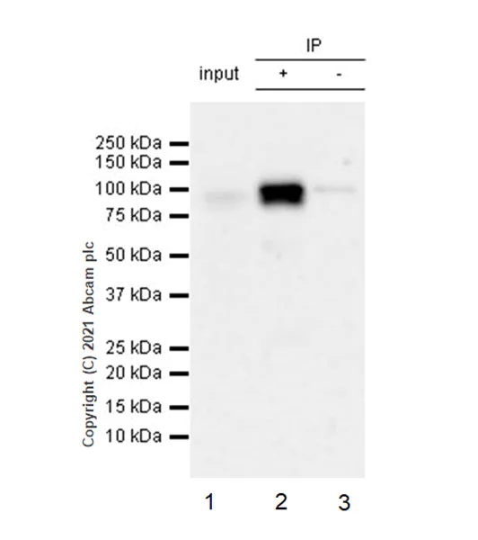 Immunoprecipitation - Anti-EEF2K antibody [EPR24714-88] (AB270948)