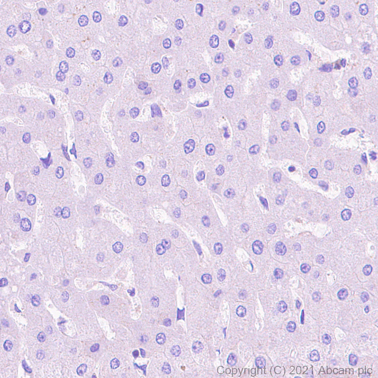 Immunohistochemistry (Formalin/PFA-fixed paraffin-embedded sections) - Anti-EEF2K antibody [EPR24714-88] - BSA and Azide free (AB283706)