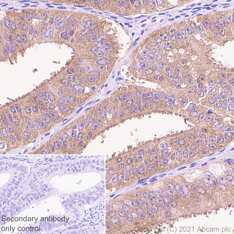 Immunohistochemistry (Formalin/PFA-fixed paraffin-embedded sections) - Anti-EEF2K antibody [EPR24714-88] - BSA and Azide free (AB283706)