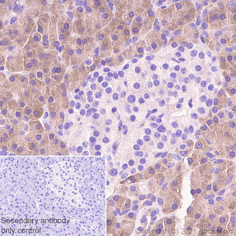 Immunohistochemistry (Formalin/PFA-fixed paraffin-embedded sections) - Anti-EEF2K antibody [EPR24714-88] - BSA and Azide free (AB283706)