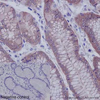 Immunohistochemistry (Formalin/PFA-fixed paraffin-embedded sections) - Anti-EEF2K (phospho S359) antibody [EPR2252(N)] (AB192257)