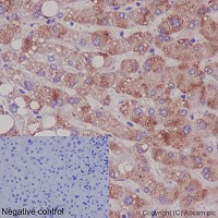 Immunohistochemistry (Formalin/PFA-fixed paraffin-embedded sections) - Anti-EEF2K (phospho S359) antibody [EPR2252(N)] (AB192257)