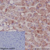 Immunohistochemistry (Formalin/PFA-fixed paraffin-embedded sections) - Anti-EEF2K (phospho S359) antibody [EPR2252(N)] - BSA and Azide free (AB251126)