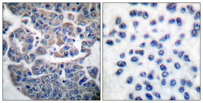 Immunohistochemistry (Formalin/PFA-fixed paraffin-embedded sections) - Anti-EEF2K (phospho S366) antibody (AB51227)