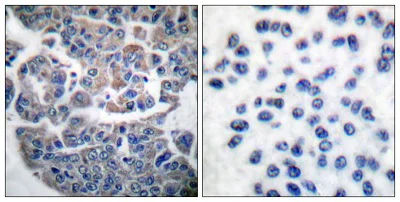 Immunohistochemistry (Formalin/PFA-fixed paraffin-embedded sections) - Anti-EEF2K (phospho S366) antibody (AB51227)