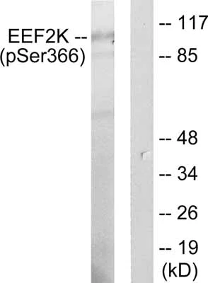 Western blot - Anti-EEF2K (phospho S366) antibody (AB51227)