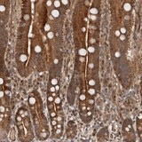 Immunohistochemistry (Formalin/PFA-fixed paraffin-embedded sections) - Anti-EFCAB1 antibody (AB121758), expandable thumbnail