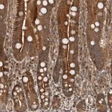 Immunohistochemistry (Formalin/PFA-fixed paraffin-embedded sections) - Anti-EFCAB1 antibody (AB121758)