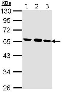 Western blot - Anti-EFEMP1/Fibulin-3 antibody (AB151976)