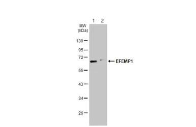 Western blot - Anti-EFEMP1/Fibulin-3 antibody (AB151976)