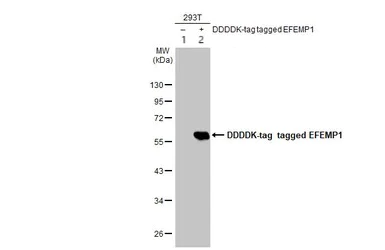 Western blot - Anti-EFEMP1/Fibulin-3 antibody (AB151976)