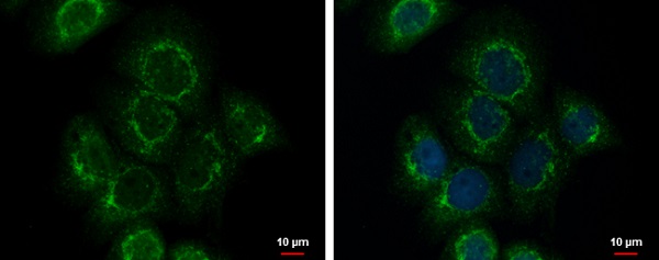 Immunocytochemistry/ Immunofluorescence - Anti-EFEMP1/Fibulin-3 antibody (AB228797)