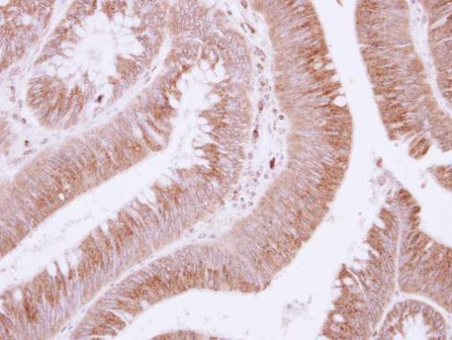 Immunohistochemistry (Formalin/PFA-fixed paraffin-embedded sections) - Anti-EFEMP1/Fibulin-3 antibody (AB228797)